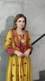 ⁦Ypl⁩ - الصورة ⁦4⁩